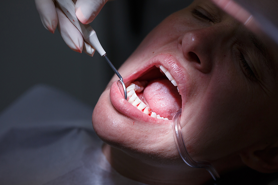 Effective Gum Disease Therapy in Elk Grove, CA: Protecting Your Oral Health