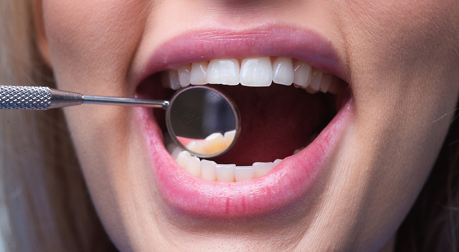 How Dental Implants Improve Your Smile, Speech, and Chewing Ability